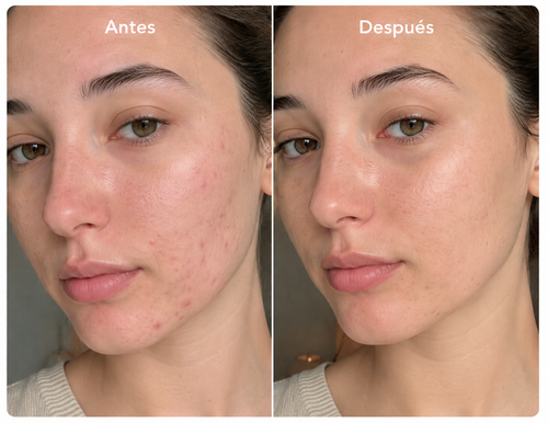 Crema Facial Jelly con Colágeno